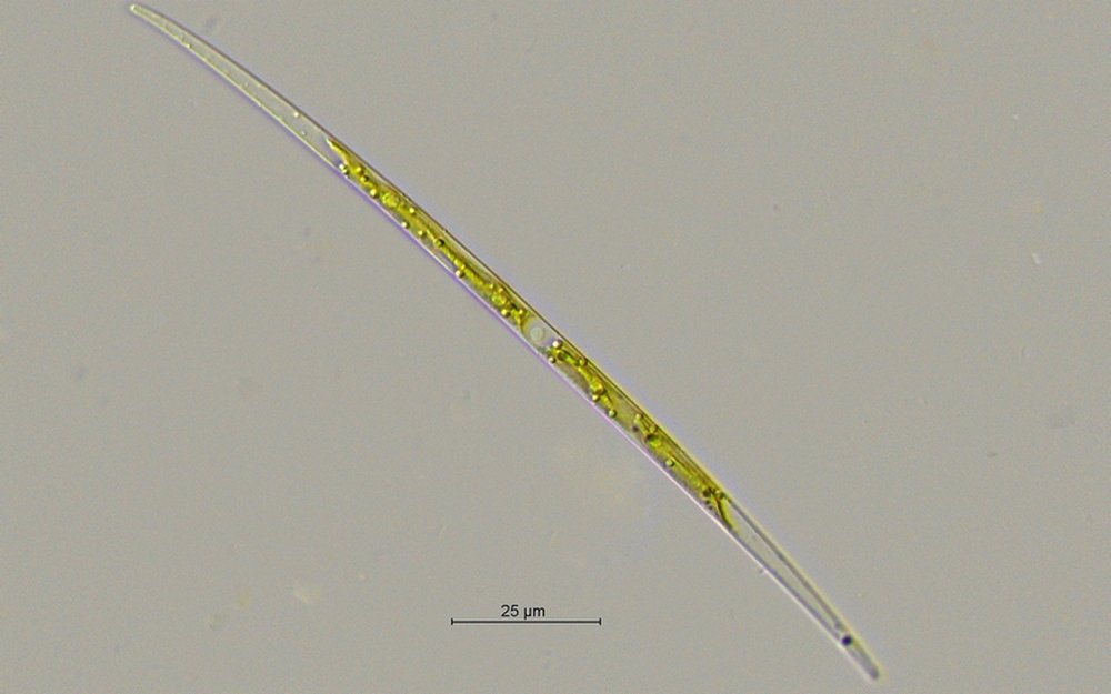 Closterium cf.idiosporum_60x.jpg