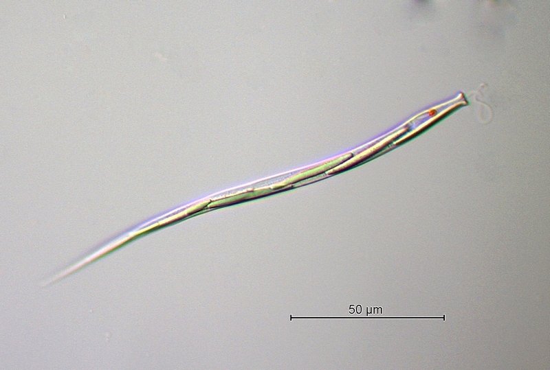 Cyclidiopsis acus.jpg