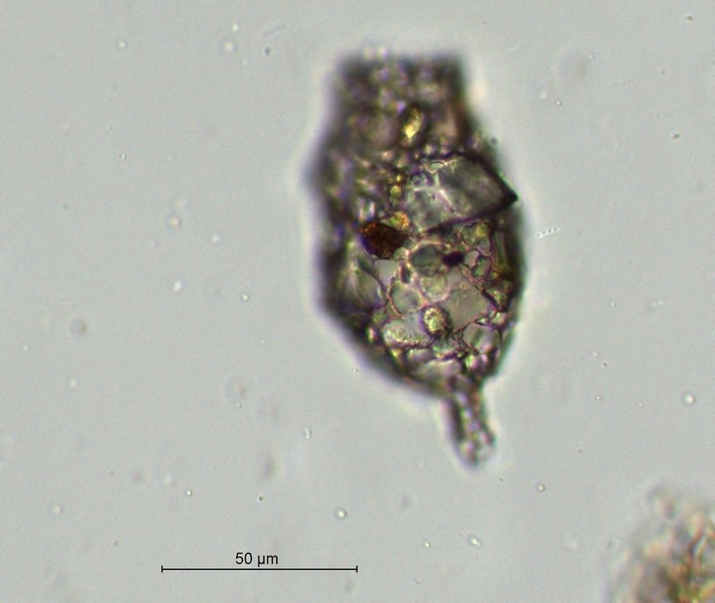 Difflugia spec._1_40x.jpg