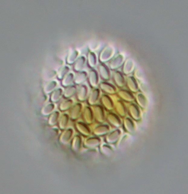 40 µm. Ist das vielleicht ein Ei?