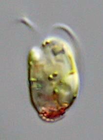 20 µm. Ein sehr kleiner Augenflagellat.
