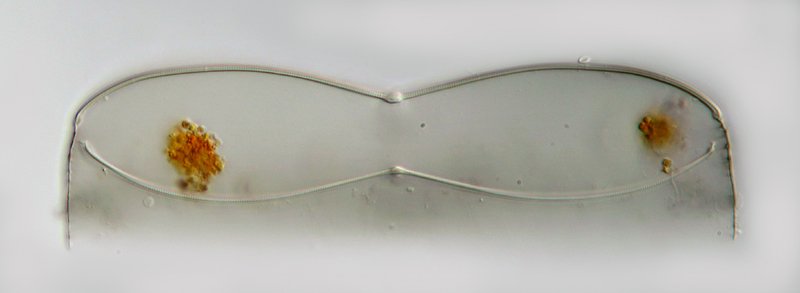 Das war in der zweiten Fotostrecke, als die Algen schon tot waren. Ich vermute, dass man hier von oben in eine leere Valve schaut.