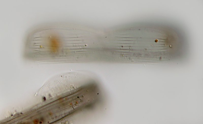 Hier ist dasselbe Objekt in einer anderen Schärfe aufgenommen. Man sieht Strukturen der Oberfläche der Valve, vermutlich das Gürtelband. Unten sieht man dann noch ein weiteres Individuum.