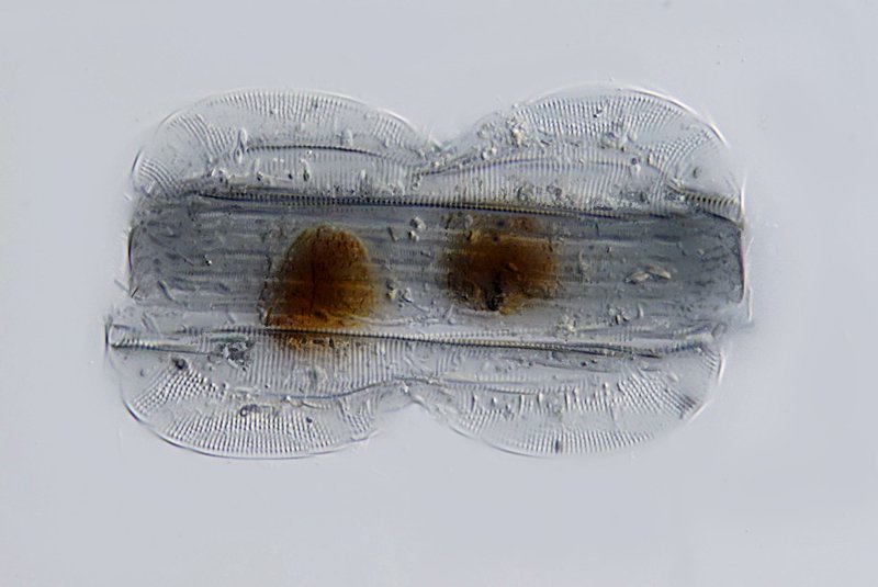 Dies ist mein Versuch des Stacking, wo man die gesamte Form in einer Ebene sieht. In der Realität ist die Art aber verdreht.