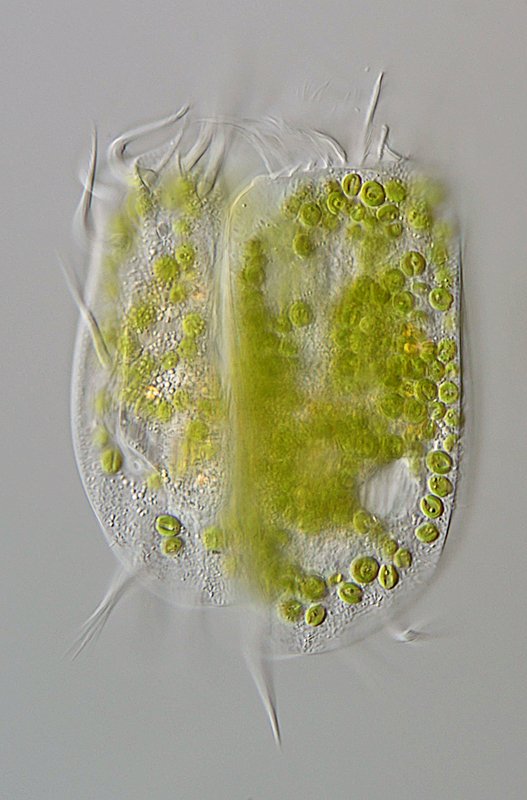 GT Euplotes daidaleos 01B-800.jpg