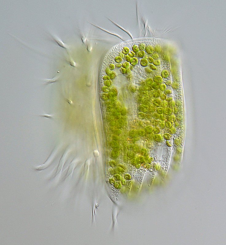 GT Euplotes daidaleos 02B-800.jpg