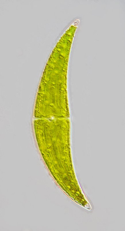 RT Closterium Stack 02B800.jpg