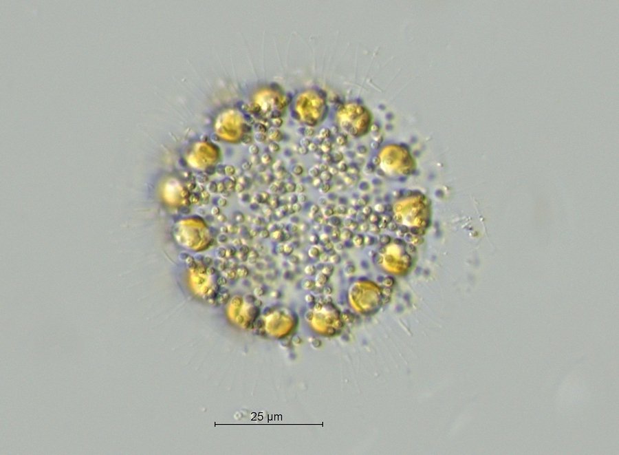 Chrysostephanosphaera globulifera_2.jpg