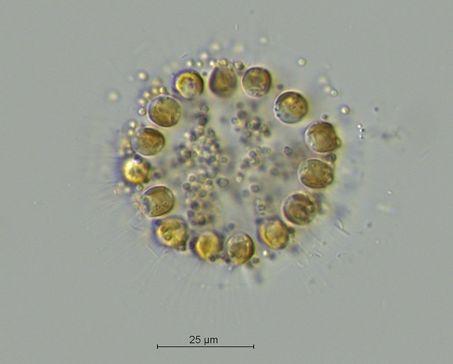 Chrysostephanosphaera globulifera_3.jpg