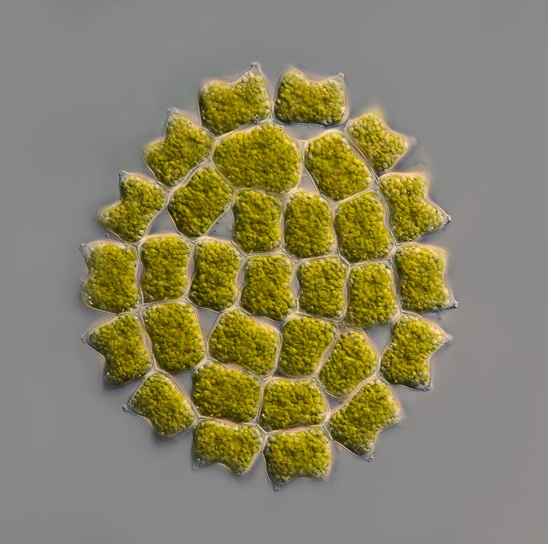 Pediastrum cf. boryanum - 125 µm