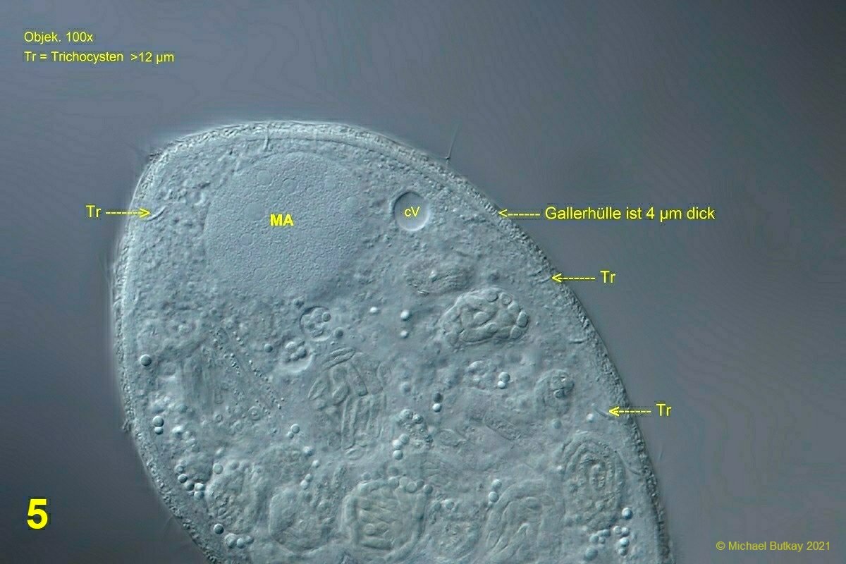 bild 5_sonderia tubigula.jpg