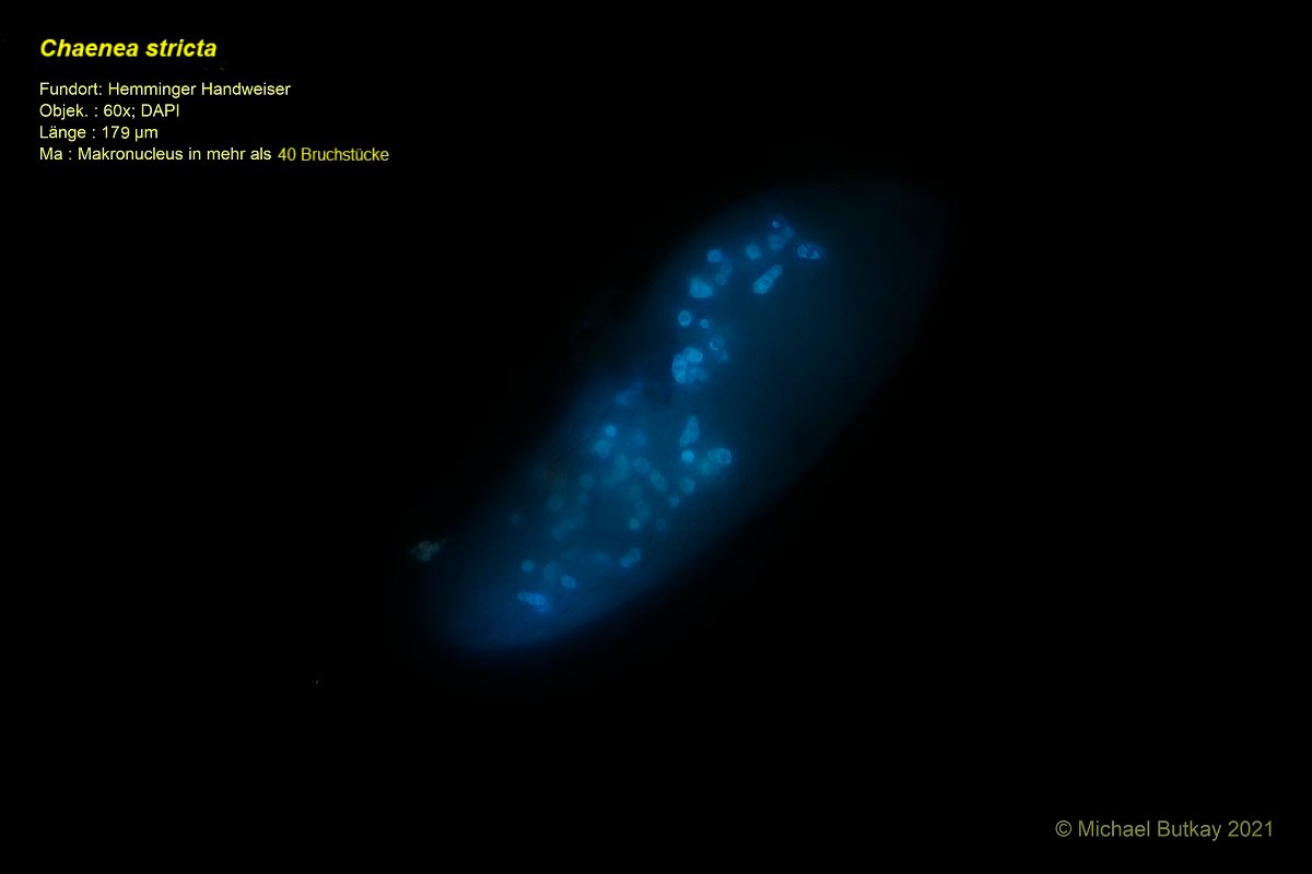 In der Fluoreszenz lassen sich sehr gut die Kerne darstellen