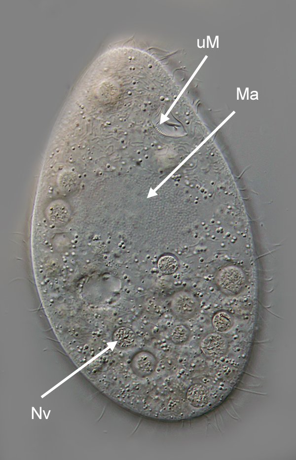 Auf diesem Bild ist die undulierende Membran (uM), der Makronucleus (Ma) und eine Nahrungsvakuole (Nv) gekennzeichnet.