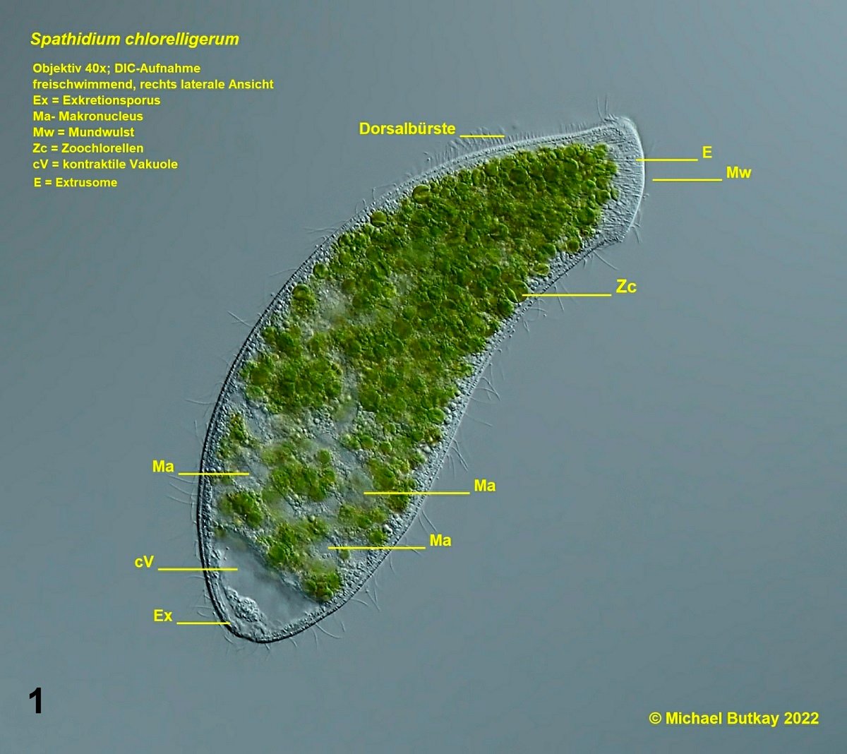 Bild 1_spathidium chlorelligerum_i4a3730.jpg