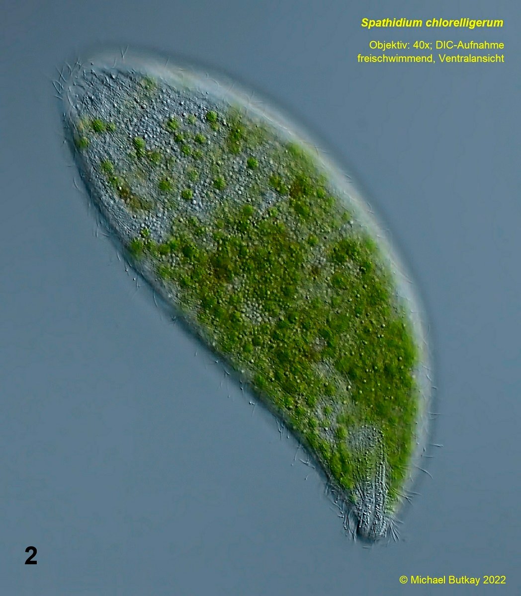 Bild 2 Spathidium chlorelligerum_i4a3194.jpg