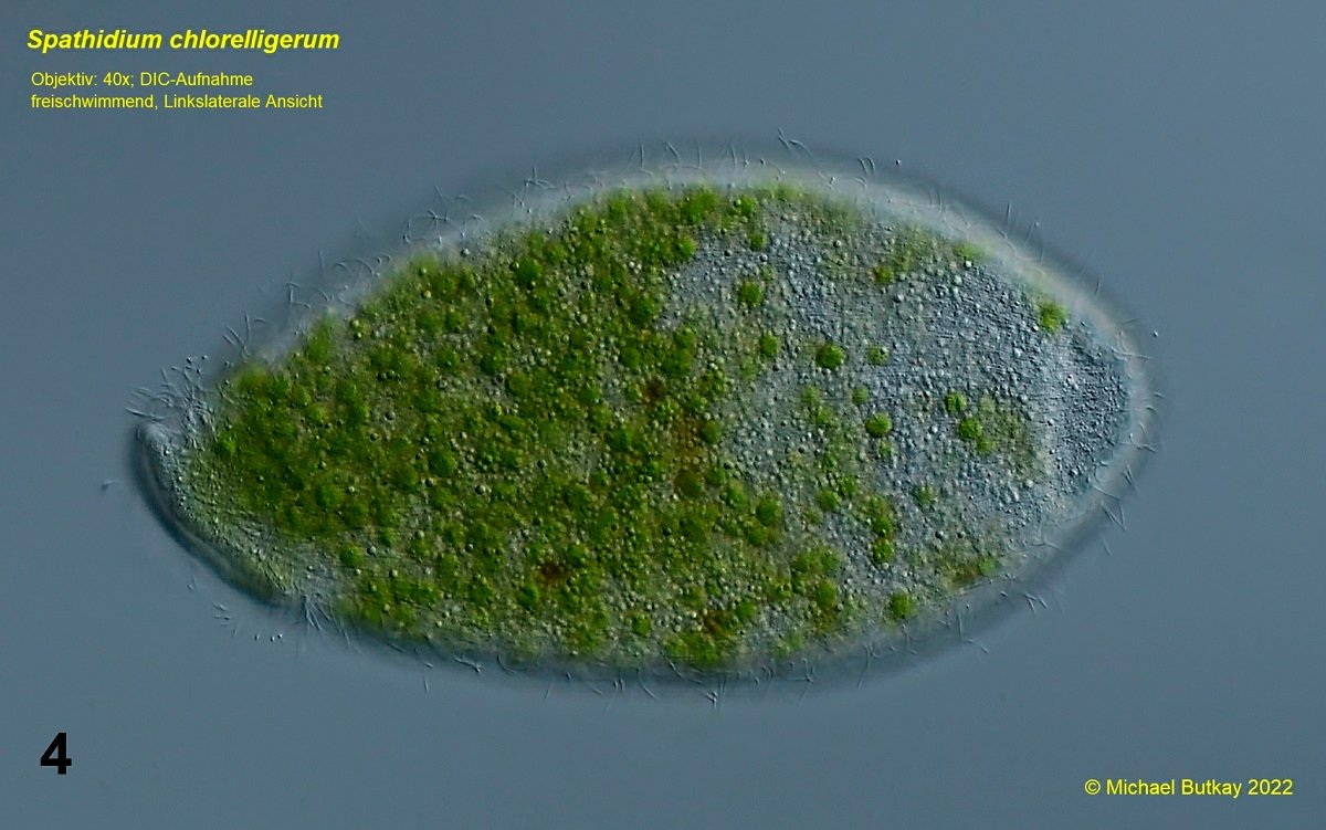 Bild 4_ Spathidium chlorelligerum_I4A3190.jpg