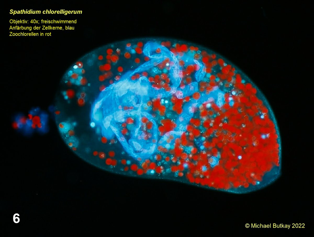 Bild 6_Spathidium chlorelligerum_I4A2541.jpg