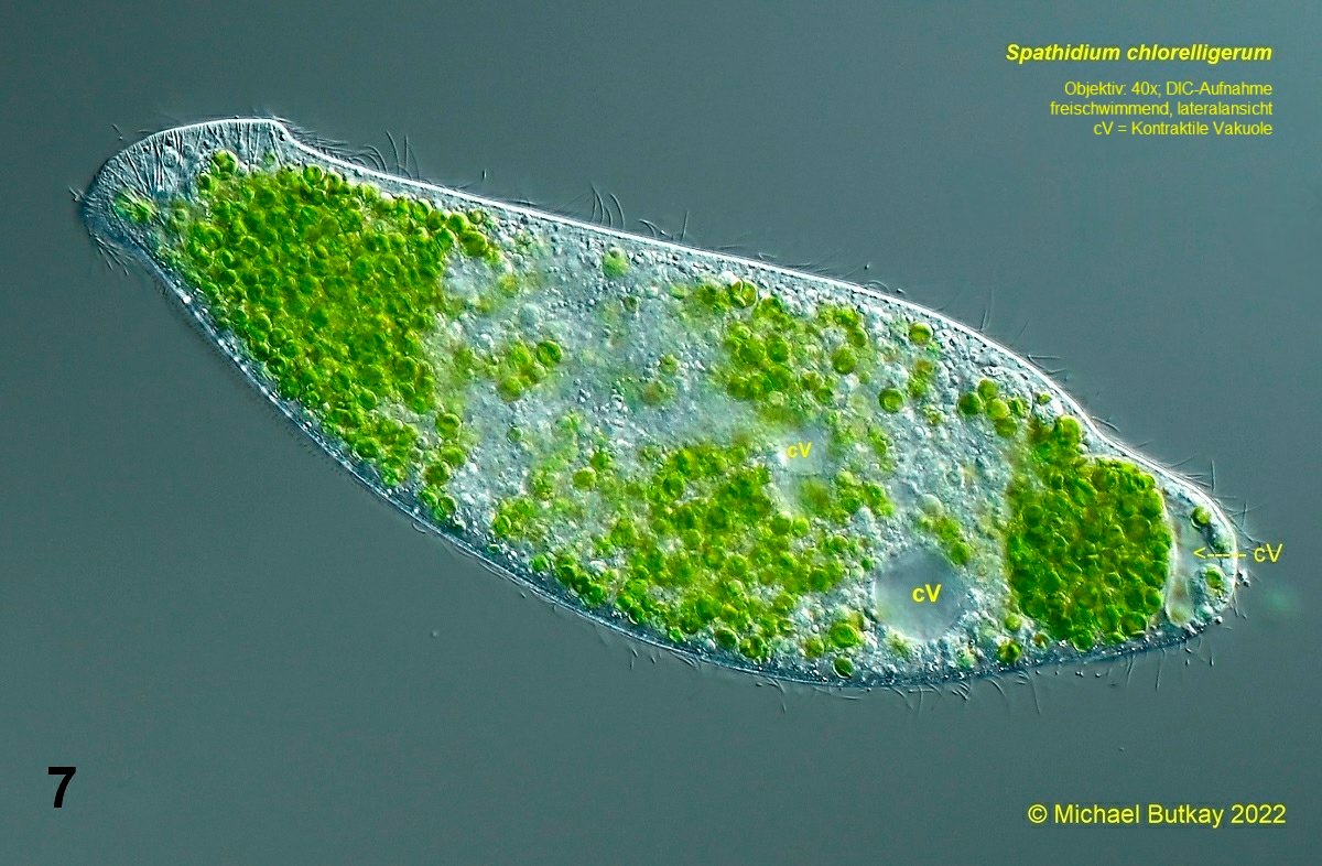 Bild 7_Spathidium chlorelligerum_i4a2468.jpg