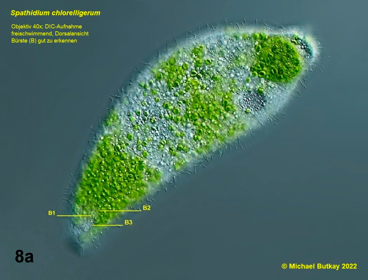 Bild 8a Spathidium chlorelligerum_i4a2462.jpg