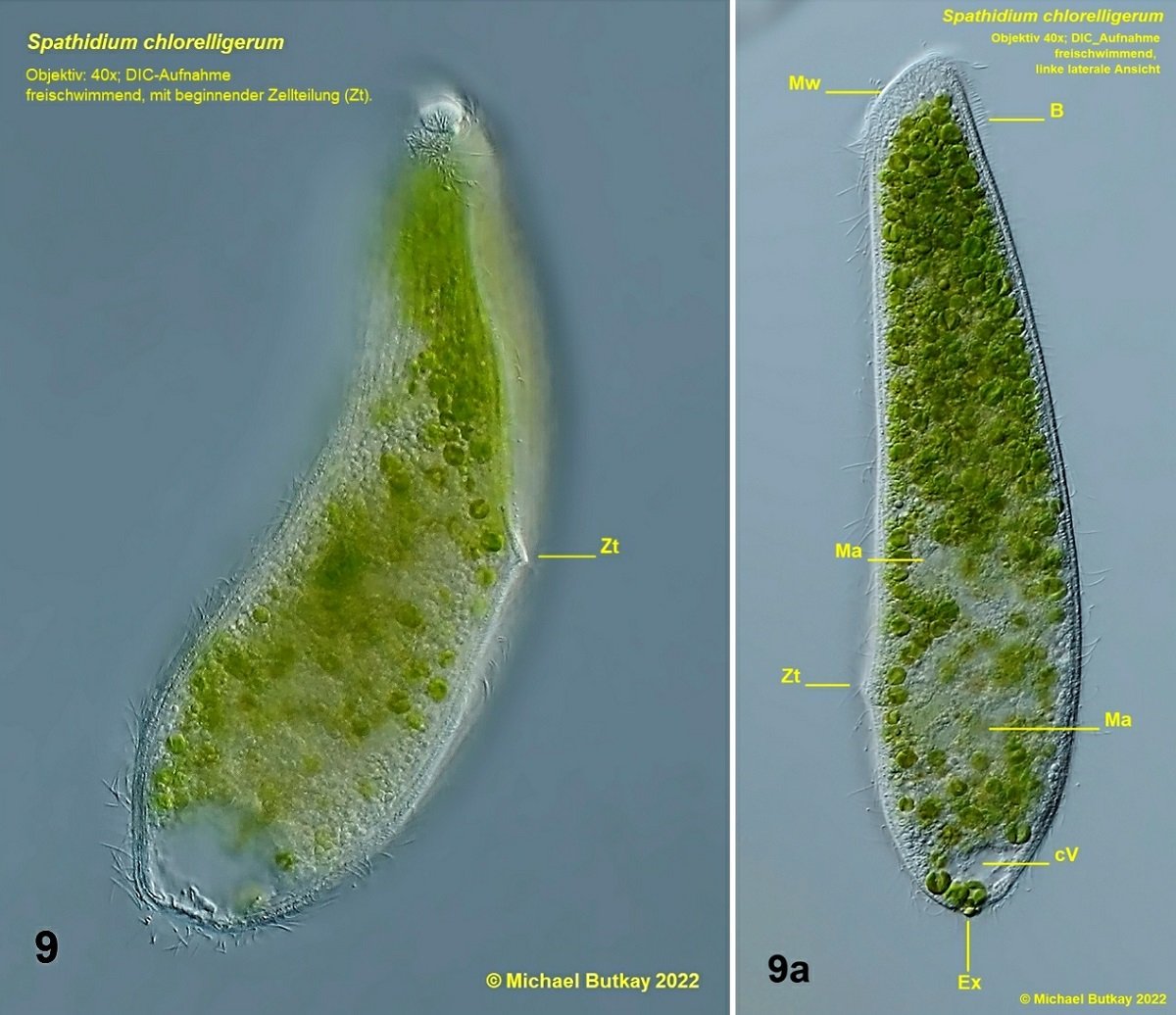 bild 9_spathidium chlorelligerum_i4a_2999-3775.jpg