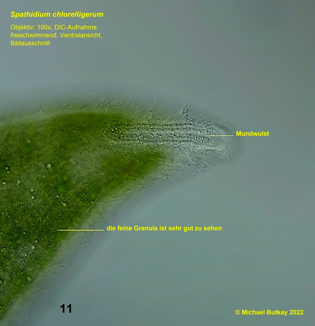 Bild 11Spathidium chlorelligerum_i4a3285.jpg
