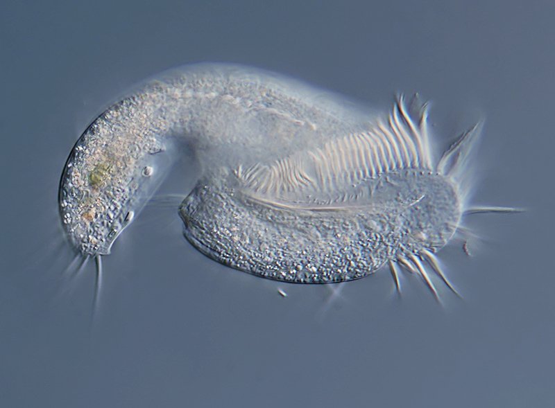 D Oxytrichidae 03 - 150 µm.jpg