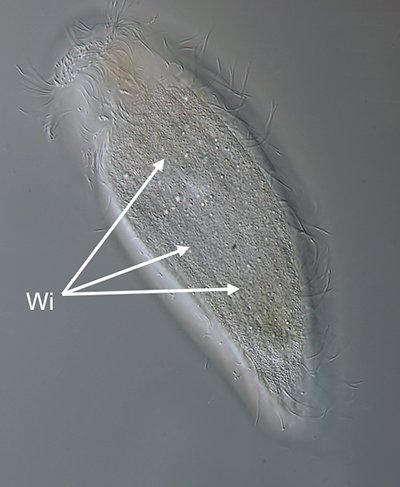 GT Metopus es 04-175µm - 400.jpg