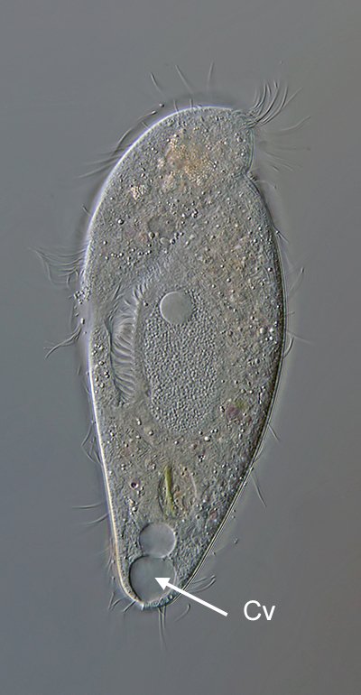 GT Metopus es 09-175µm - 400.jpg