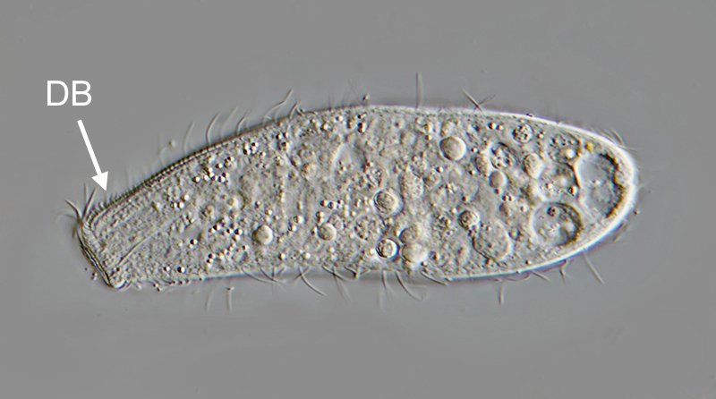 MT 800 Spathidium muscicola 01 - 125 µm.jpg