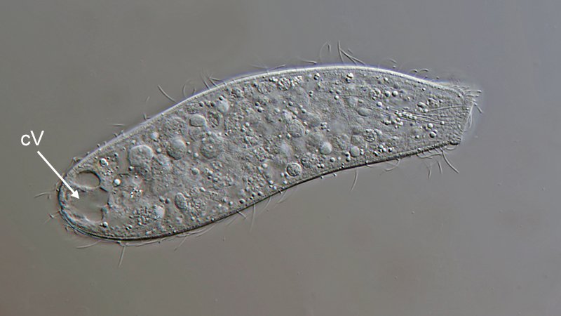 MT 800 Spathidium muscicola 05 - 125 µm.jpg