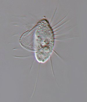 HWS Cyclidium glaucum 02 - 20 µm 300.jpg