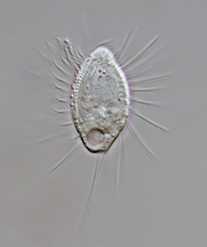 HWS Cyclidium glaucum 01 - 20 µm 300.jpg