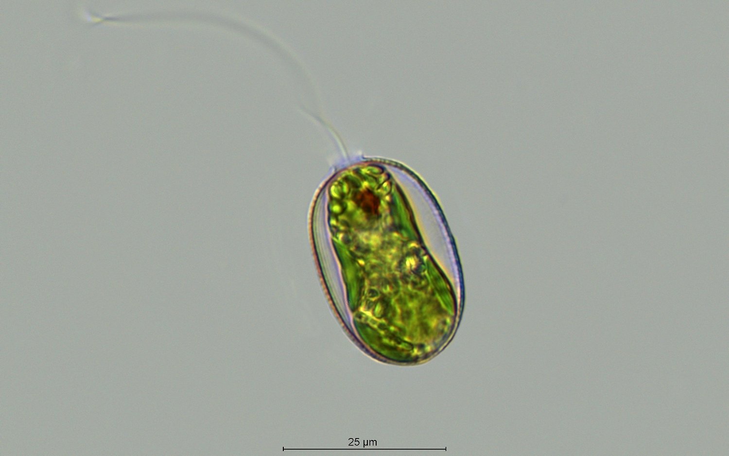 Trachelomonas euchlora_100x.jpg