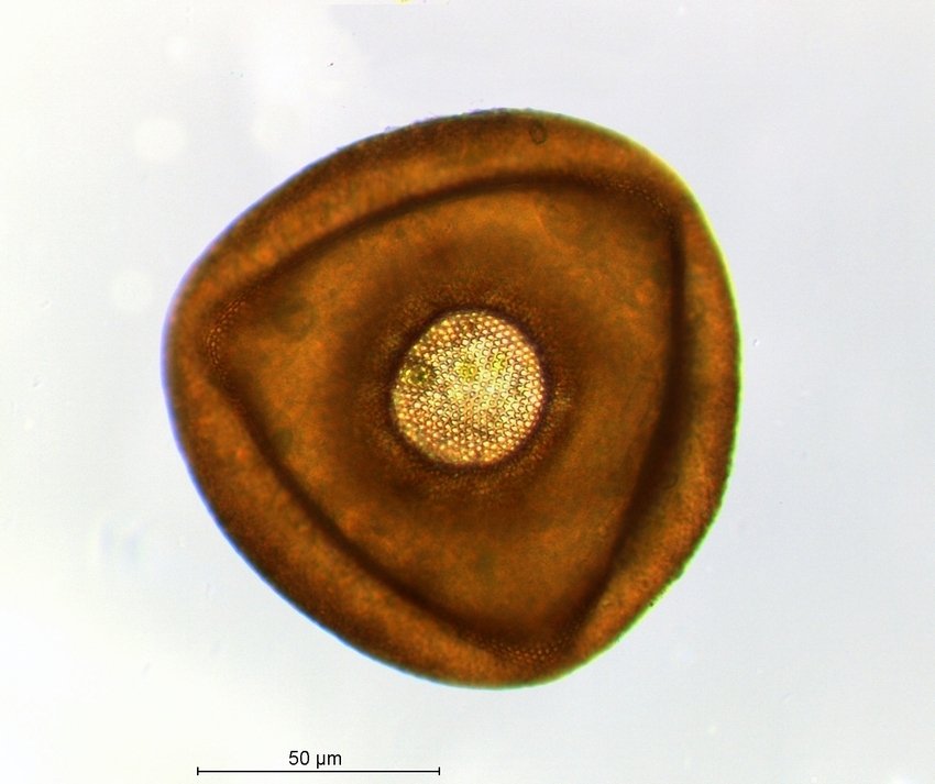 Arcella spec..jpg