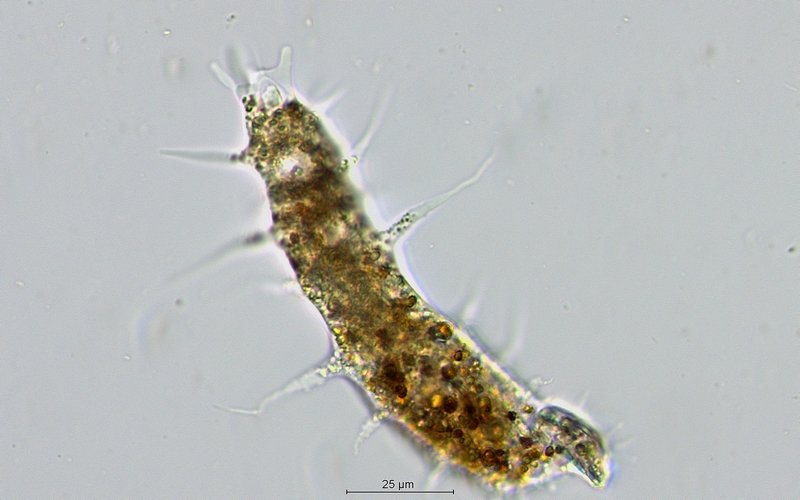Mastigamoeba cf. aspera_4.jpg