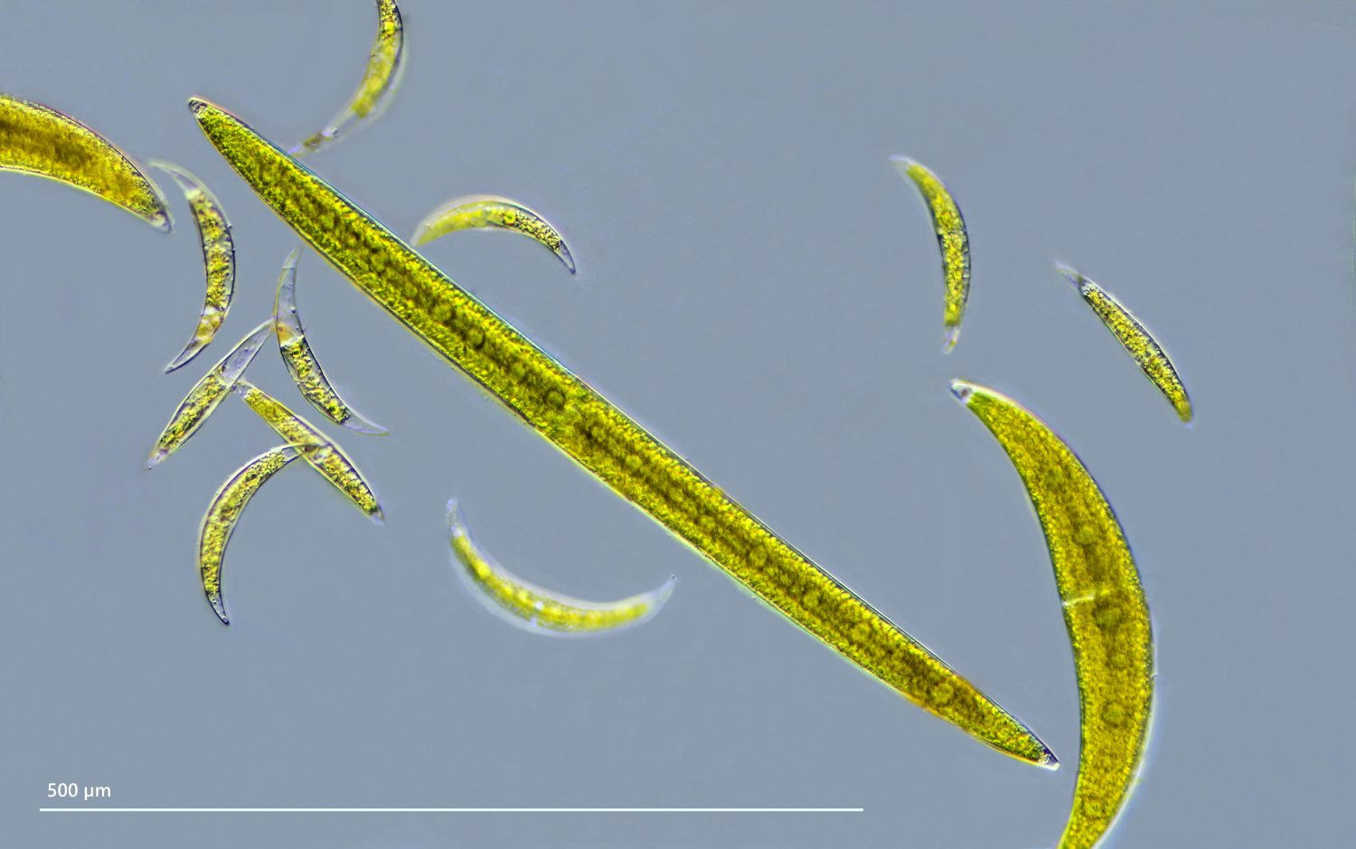 Closterium 50 closterioides Spindel-Alge DIK 25 Schwemm-Moor-Z7.jpg