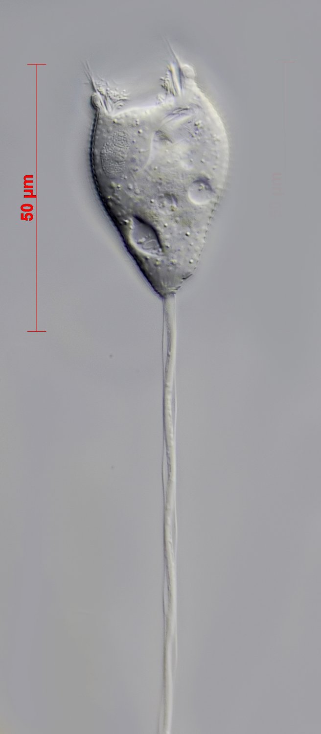 QP Vorticella aquadulcis 03.JPG