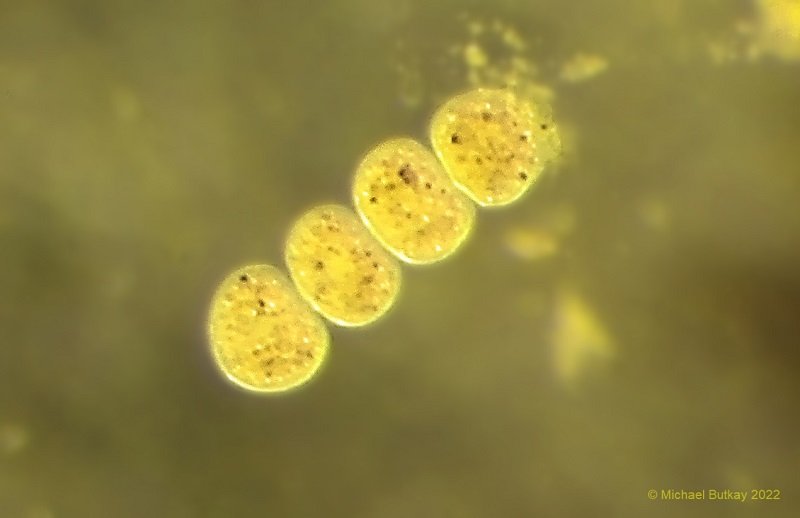 Bild 5_Tomiten von Ophryoglena flava.jpg