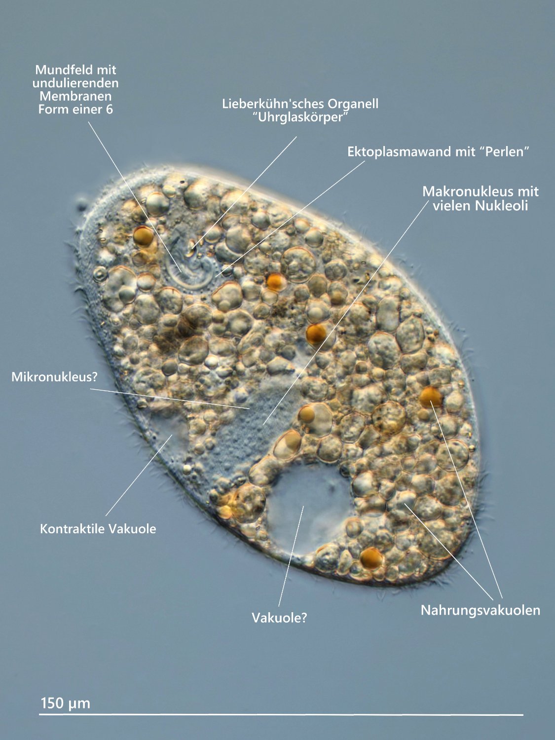 Ophryoglena 02 (ev) atra Osterei-Ciliat Beschriftung DIK 100.jpg