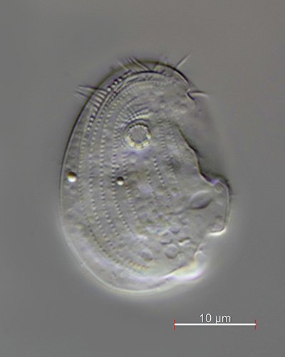 Vielleicht handelt es sich um Thigmogaster sp., aber für eine<br />genaue Bestimmung sind es zu wenige Details