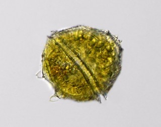 peridinium.bipes.p2.jpg