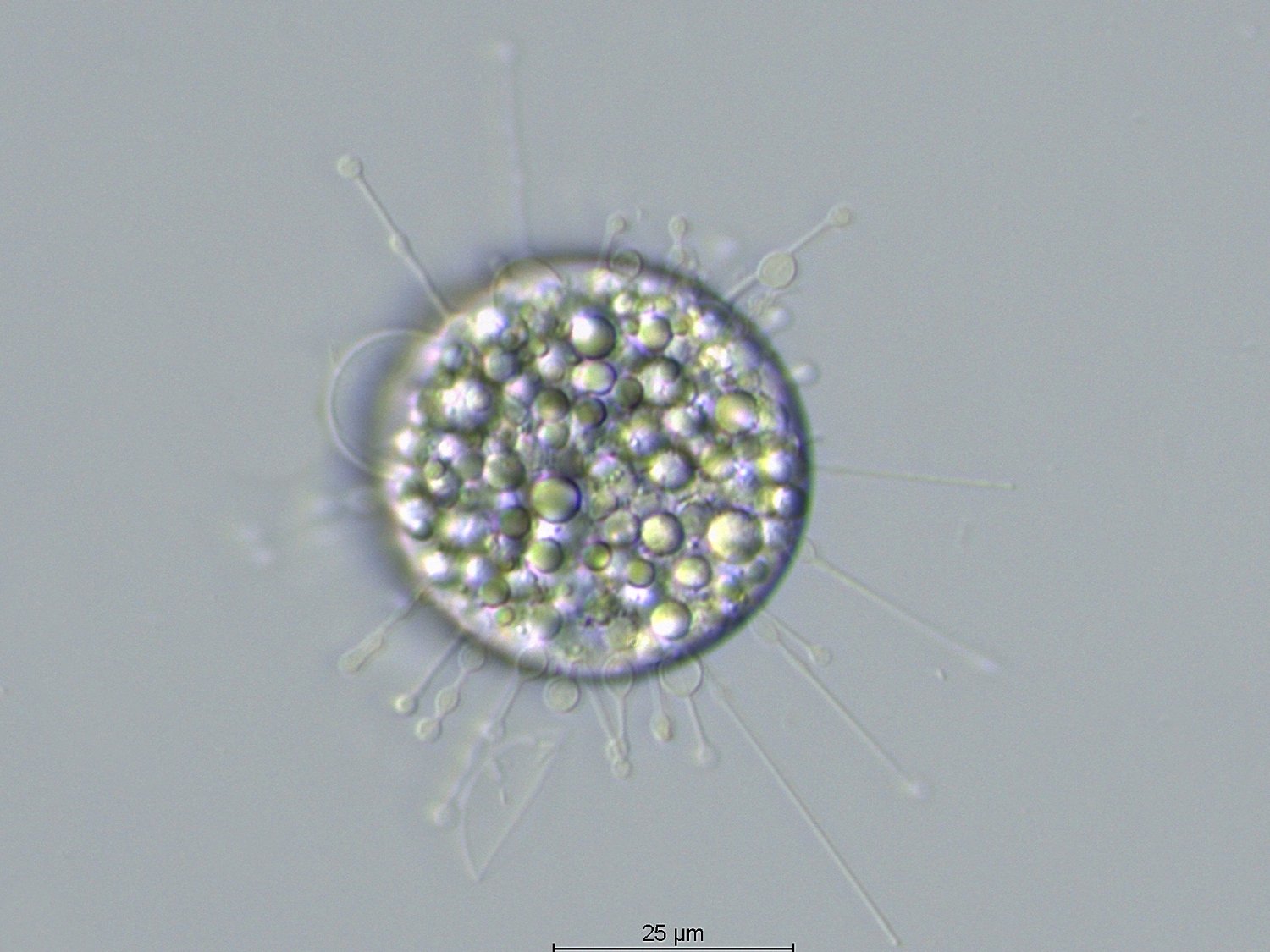 Parapodophrya soliformis_2.jpg