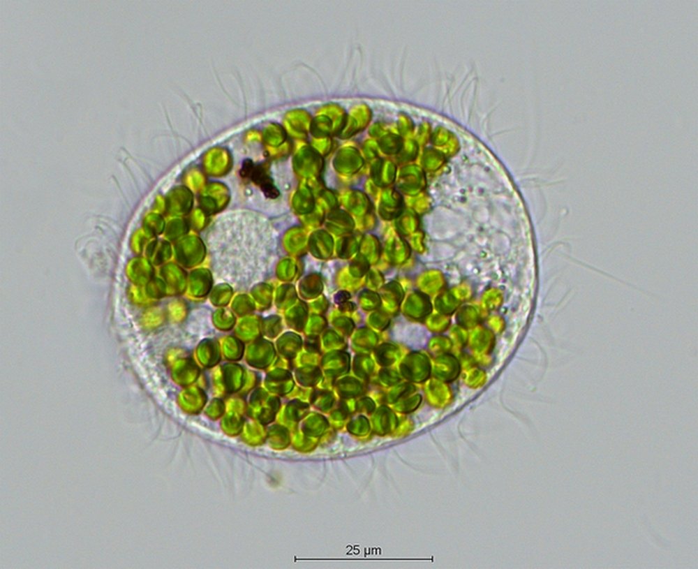 Ciliat_Image_7.jpg