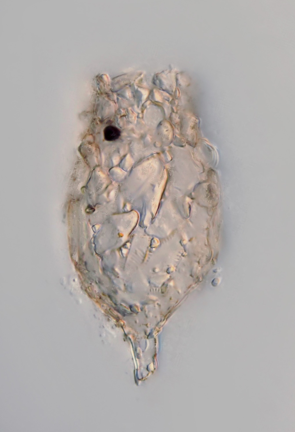 PSW Difflugia elegans 01.jpeg