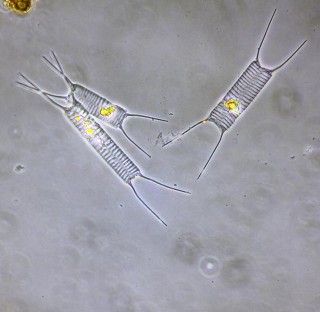 Acanthoceras (Attheya) zachariasii 7.JPG