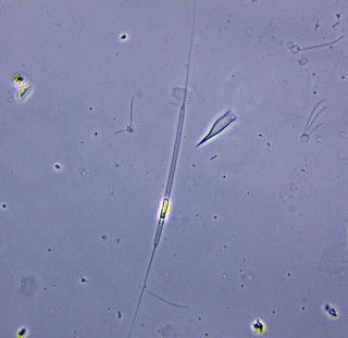 Rhizosolenia longiseta 7.JPG
