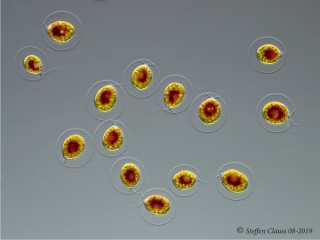 Haematococcus_p_DIC_3.jpg