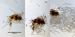 Spirostomum teres bei der Besiedelung einer Bakterienkolonie.