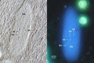 Spirostomum teres: Drei nahe beieinander liegende Micronuclei.