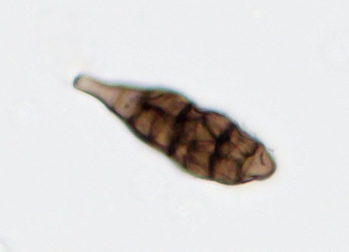 BU 007 Konidie Alternaria.jpg